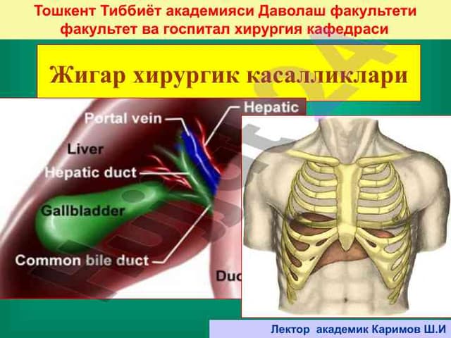 Жигар хирургик касалликлари